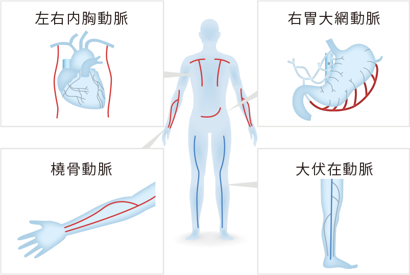 バイパスに用いる血管