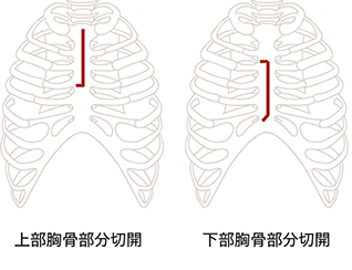 低侵襲性